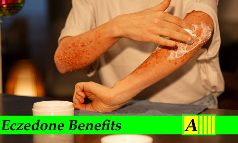 Eczedone Benefits